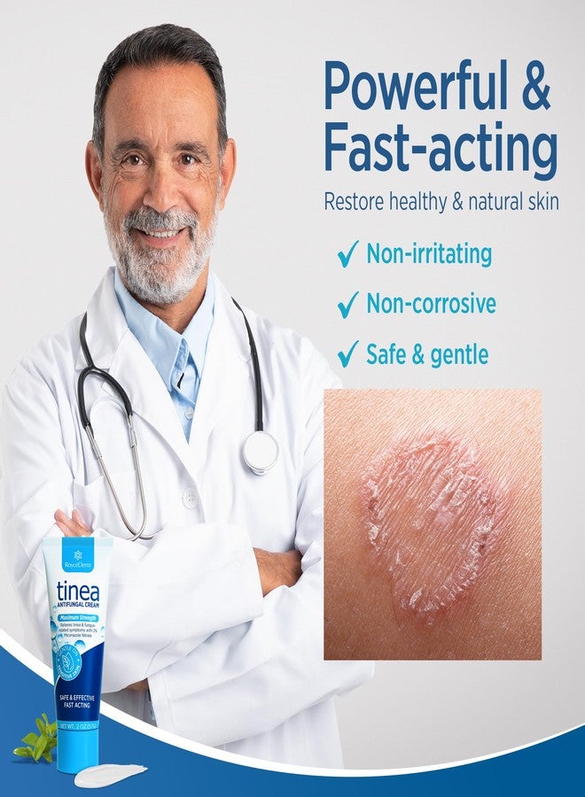 Roycederm Tinea Versicolor Treatment, Athletes Foot Treatment, Ringworm Treatment for Humans, for Tinea Versicolor & Pedis,Fast Healing Anti Fungal Skin Cream - Multi-Functional - Pack of 2 - Image 3